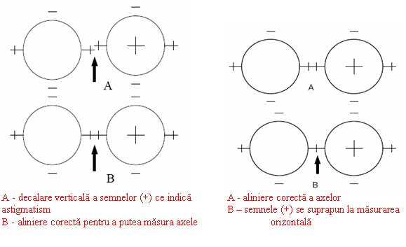 Text Box: 
A - decalare verticala a semnelor (+) ce indica A - aliniere corecta a axelor
astigmatism B - semnele (+) se suprapun la masurarea 
B - aliniere corecta pentru a putea masura axele orizontala
