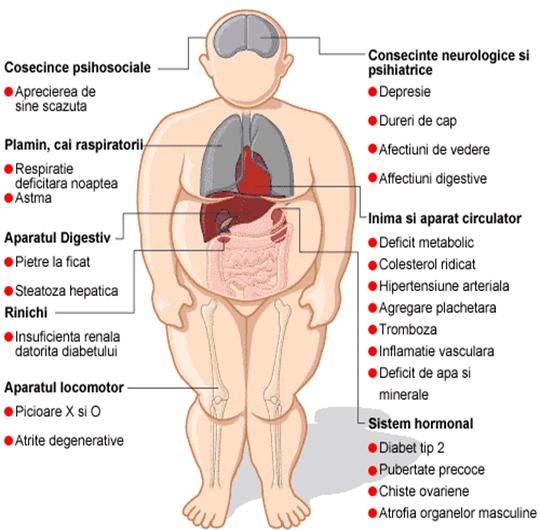 Consecintele obezitatii
